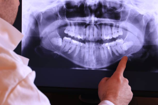 Best Weekend Emergency Dentist in Beverly, NJ