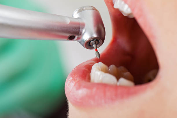 Best Pediatric Emergency Dentist in Beverly, NJ